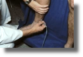 Diektionale Dopplersonographie bei Gef&auml;&szlig;erkrankungen